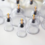 Si la sorcellerie, lorsqu’elle se mélange avec le sang, arrive à un endroit du corps où le mal se manifeste, la Hijama pourra en diminuer les effets.